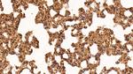 Galectin 1 Antibody in Immunohistochemistry (Paraffin) (IHC (P))