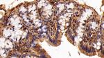 Galectin 1 Antibody in Immunohistochemistry (Paraffin) (IHC (P))