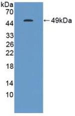GKN1 Antibody in Western Blot (WB)