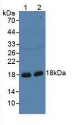 GKN1 Antibody in Western Blot (WB)