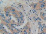 GDI1 Polyclonal Antibody