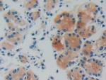 GDI1 Antibody in Immunohistochemistry (Paraffin) (IHC (P))