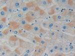 GDI1 Antibody in Immunohistochemistry (Paraffin) (IHC (P))