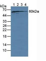 GDI1 Antibody in Western Blot (WB)