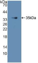 GDI1 Antibody in Western Blot (WB)