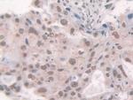Glucocorticoid Receptor Antibody in Immunohistochemistry (Paraffin) (IHC (P))