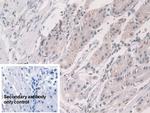 Glucocorticoid Receptor Antibody in Immunohistochemistry (Paraffin) (IHC (P))