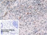 Glucocorticoid Receptor Antibody in Immunohistochemistry (Paraffin) (IHC (P))