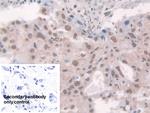 Glucocorticoid Receptor Antibody in Immunohistochemistry (Paraffin) (IHC (P))
