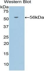 Glucocorticoid Receptor Antibody in Western Blot (WB)