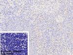 G6PD Antibody in Immunohistochemistry (Paraffin) (IHC (P))
