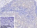 G6PD Polyclonal Antibody