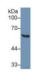 G6PD Antibody in Western Blot (WB)
