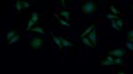 GUSB Antibody in Immunocytochemistry (ICC/IF)
