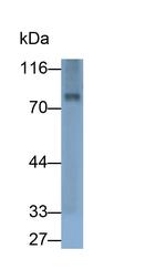 GUSB Antibody in Western Blot (WB)