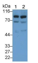 GUSB Antibody in Western Blot (WB)