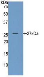 GUSB Antibody in Western Blot (WB)