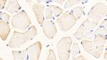 Glutaminase Antibody in Immunohistochemistry (Paraffin) (IHC (P))