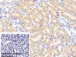 Glutaminase Antibody in Immunohistochemistry (Paraffin) (IHC (P))