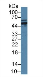 Glutaminase Antibody in Western Blot (WB)