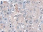 GPX3 Antibody in Immunohistochemistry (Paraffin) (IHC (P))