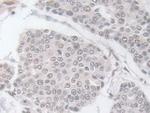 GPX3 Antibody in Immunohistochemistry (Paraffin) (IHC (P))
