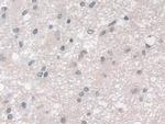 GPX3 Antibody in Immunohistochemistry (Paraffin) (IHC (P))