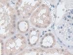 GPX3 Antibody in Immunohistochemistry (Paraffin) (IHC (P))
