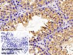 GPX4 Antibody in Immunohistochemistry (Paraffin) (IHC (P))