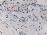 GSR Antibody in Immunohistochemistry (Paraffin) (IHC (P))