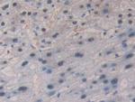 GSR Antibody in Immunohistochemistry (Paraffin) (IHC (P))