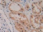 GSR Antibody in Immunohistochemistry (Paraffin) (IHC (P))