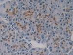 GSR Antibody in Immunohistochemistry (Paraffin) (IHC (P))