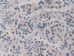 GSR Antibody in Immunohistochemistry (Paraffin) (IHC (P))