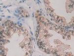 GSR Antibody in Immunohistochemistry (Paraffin) (IHC (P))