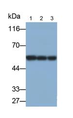 GSR Antibody in Western Blot (WB)