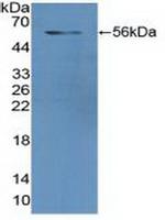 GSR Antibody in Western Blot (WB)