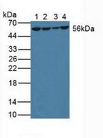 GSR Antibody in Western Blot (WB)