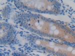 GSTA4 Antibody in Immunohistochemistry (Paraffin) (IHC (P))