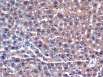 GSTA3 Antibody in Immunohistochemistry (Paraffin) (IHC (P))