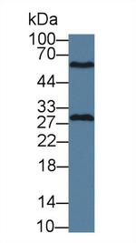 GSTM4 Polyclonal Antibody
