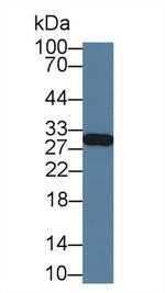 GSTM4 Antibody in Western Blot (WB)