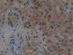 GSTT2 Polyclonal Antibody