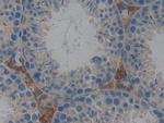 GSTT2 Antibody in Immunohistochemistry (Paraffin) (IHC (P))