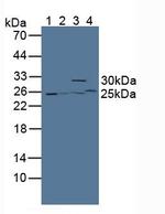 GSTT2 Antibody in Western Blot (WB)