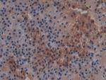 GSTT2 Polyclonal Antibody