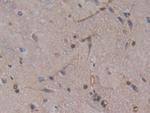 GSTT2 Antibody in Immunohistochemistry (Paraffin) (IHC (P))