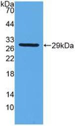 GSTT2 Antibody in Western Blot (WB)