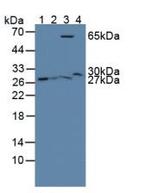GSTT2 Antibody in Western Blot (WB)