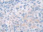 PYGB Antibody in Immunohistochemistry (Paraffin) (IHC (P))